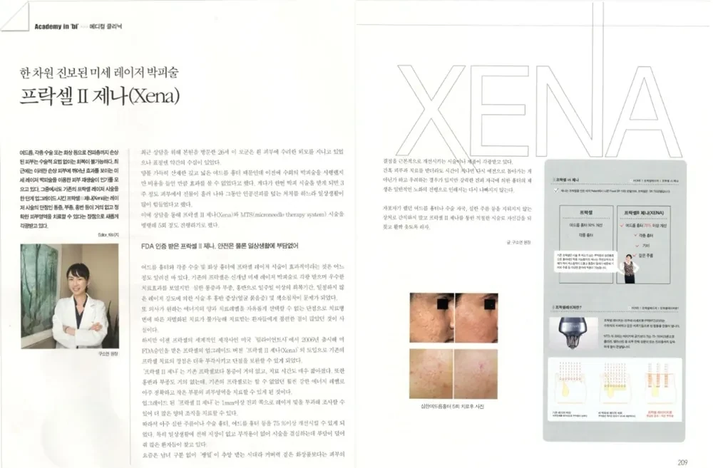 为《bi》Fraxel Xena专题提供专业意见