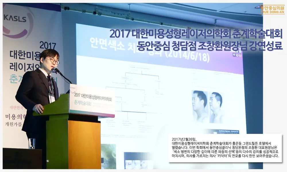 童颜中心诊所清潭院区曹昌焕院长在2017韩国美容整形激光医学会春季学术大会演讲