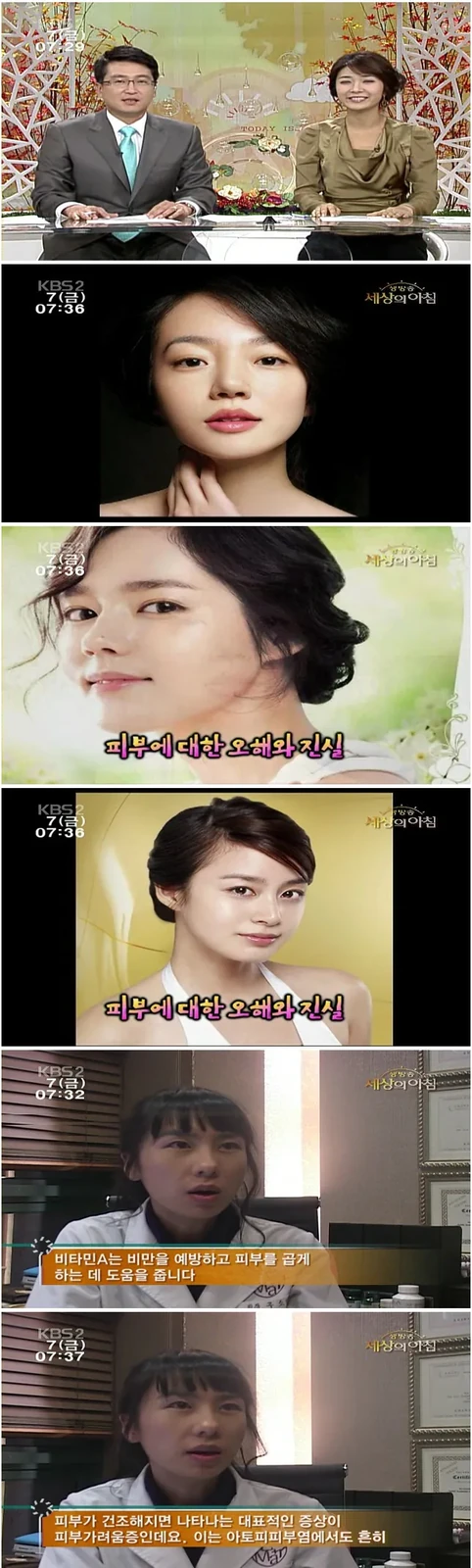 具昭延院长参加KBS《直播世界的早晨》（2）