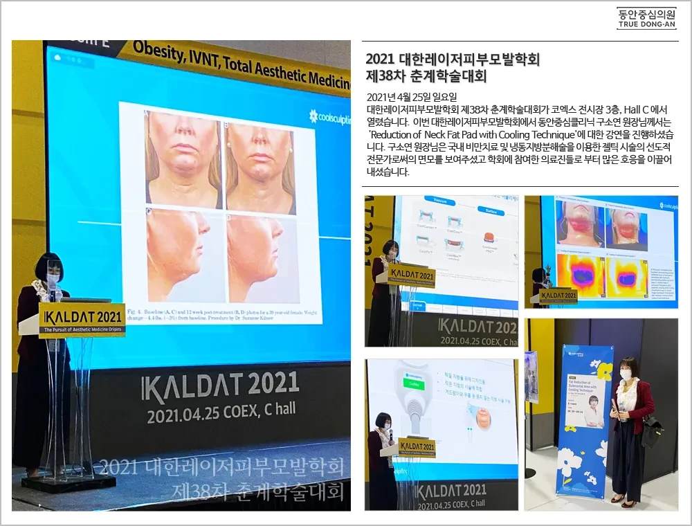 具昭延院长在2021韩国激光皮肤毛发学会第38届春季学术大会演讲