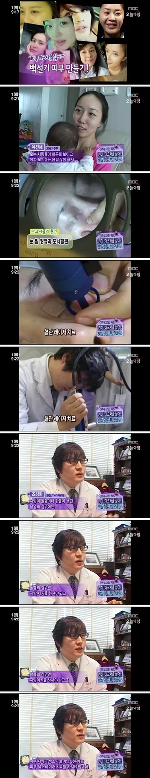 曹昌焕院长为MBC《直播今天早晨》提供专业解读