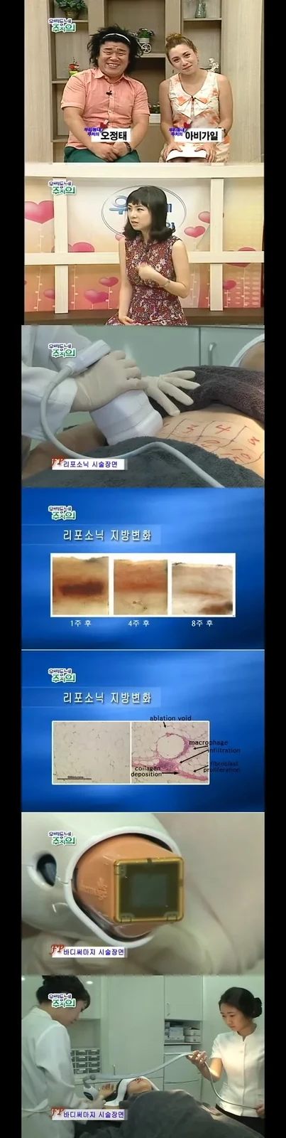 《我们社区的主治医生》：LipoSonix与身体热玛吉