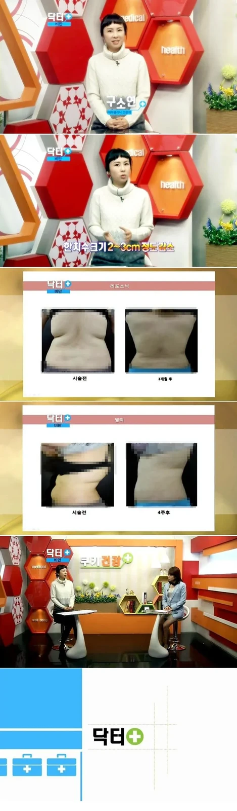 Kuki TV《Doctor Plus》肥胖篇